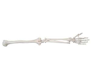 Upper limb skeletal model