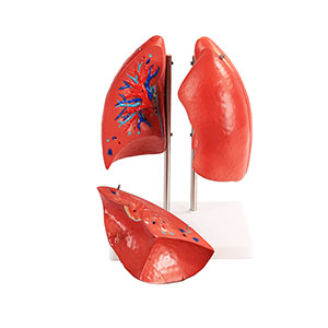 Lung anatomy model